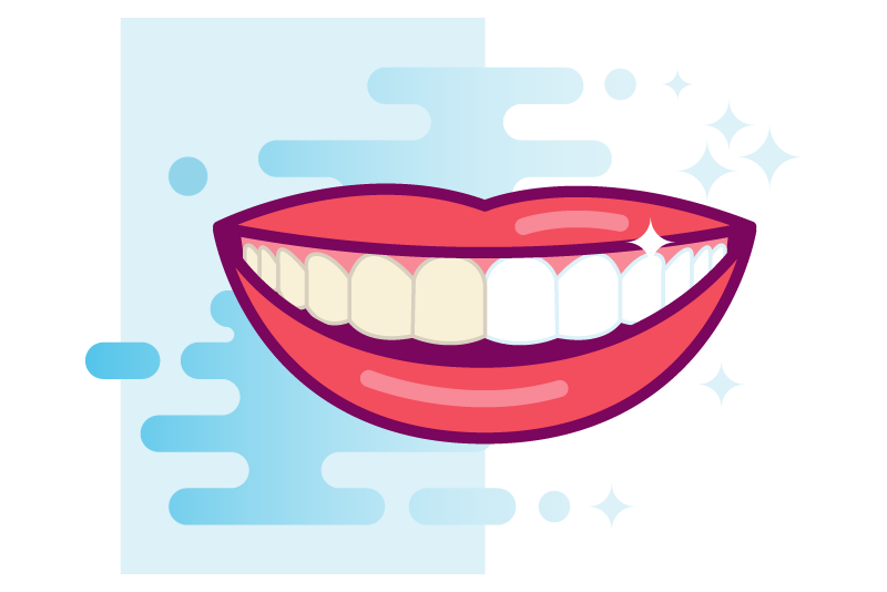 Cosmetic teeth whitening illustration